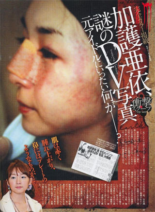 加護亜衣　過去のDV被害