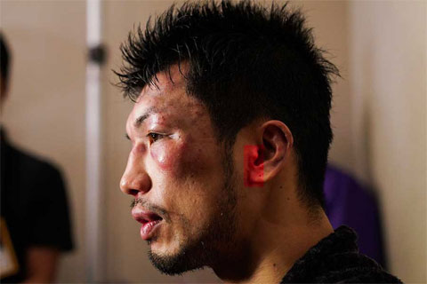 負傷した村田